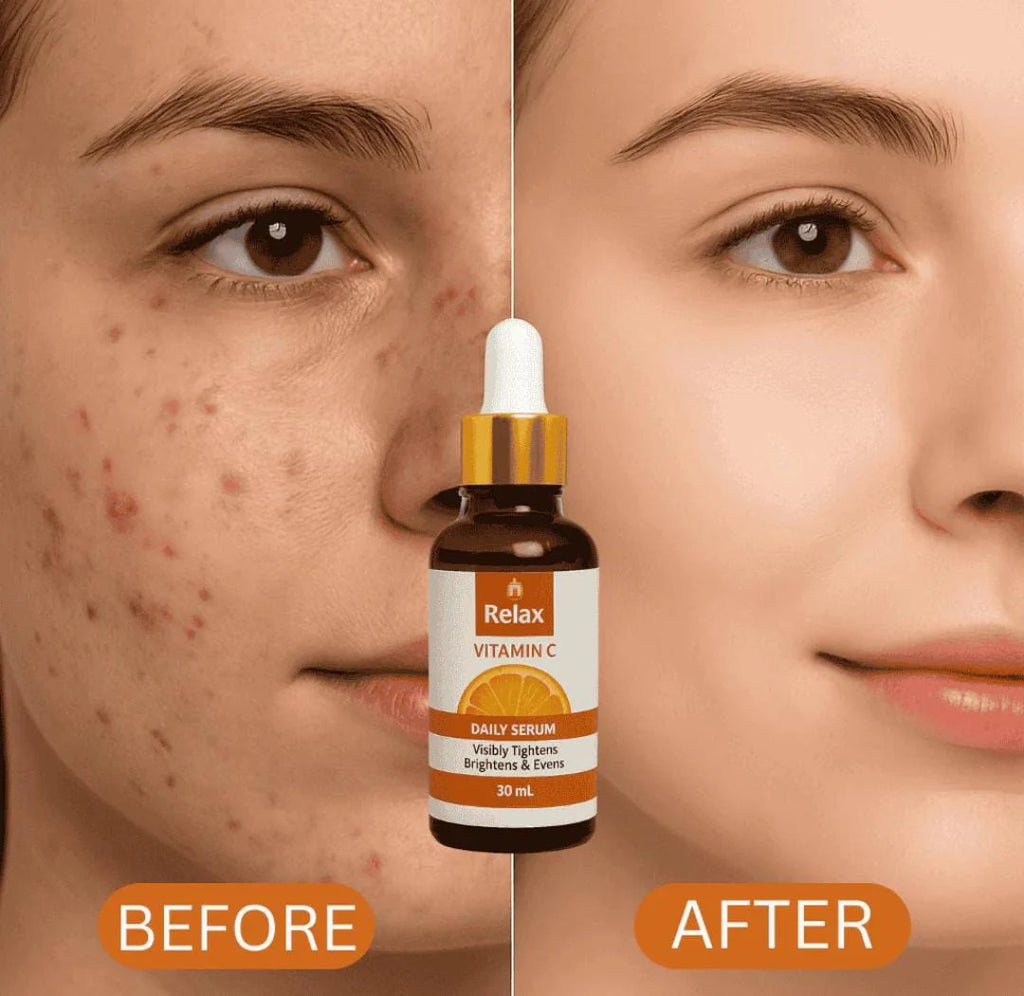 Relax Vitamin C Daily Face Serum (30ml)