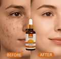 Relax Vitamin C Daily Face Serum (30ml)